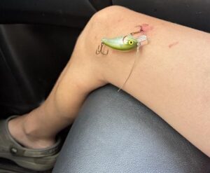 Another Fishing Story_Bucktail Medical Center